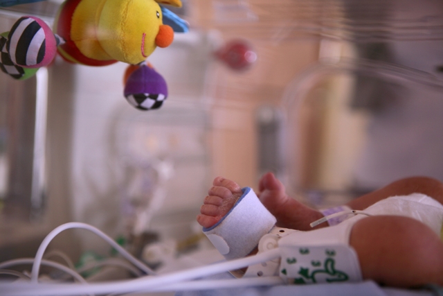 Baby's foot lying in crib medical equipment attached and a toy dangling above